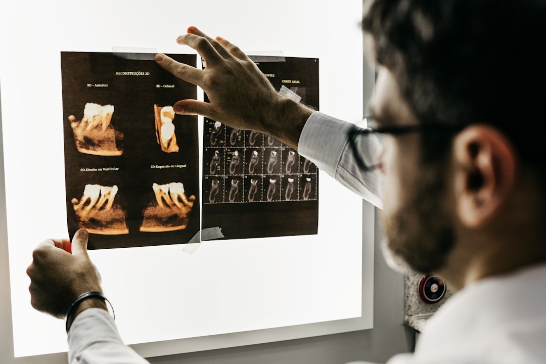 Budowa i rodzaje implantów zębowych