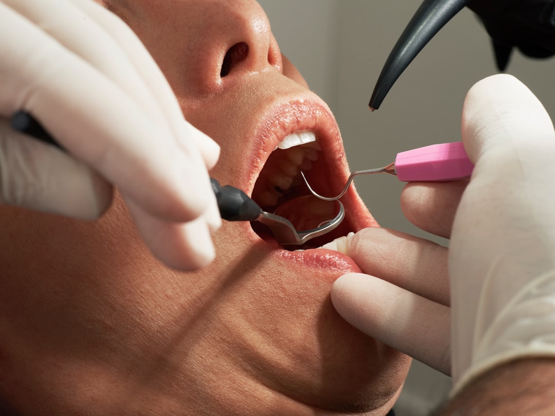 Budowa i rodzaje implantów zębowych