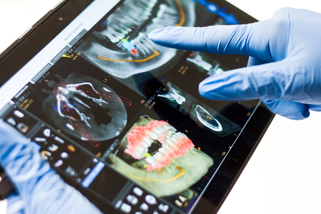 Budowa i rodzaje implantów zębowych