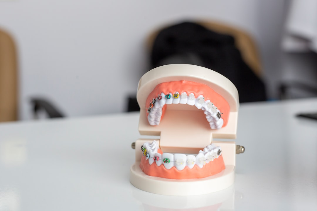 Budowa i rodzaje implantów zębowych