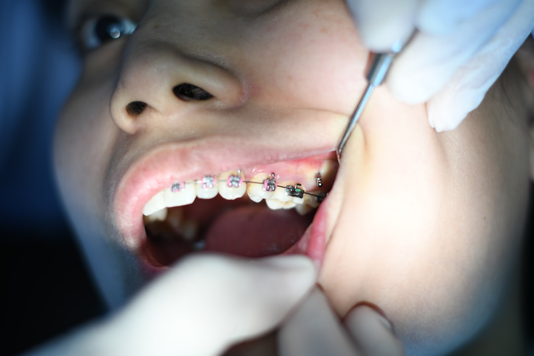 Budowa i rodzaje implantów zębowych